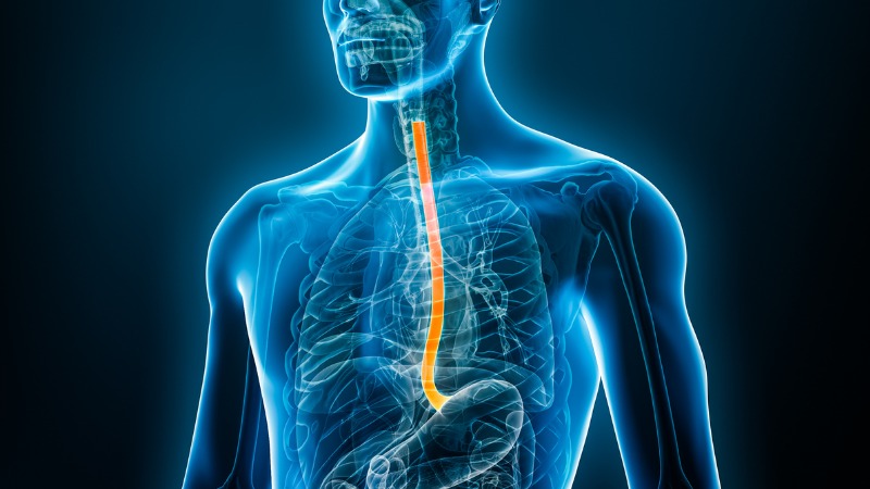 reflux-gastrique-acide-oesophage